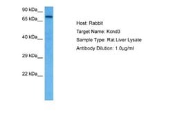 Kv4.3 Antibody, Novus Biologicals 100 &mu;L; Unconjugated:Anticuerpos